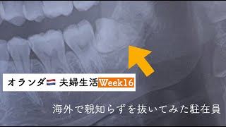 【Vlog】オランダで親知らずを抜いてみた女性駐在員