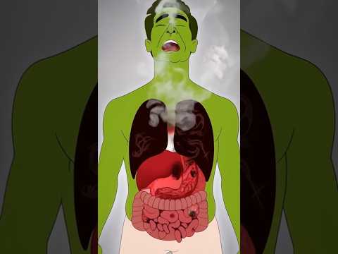 Doctors Warn Every Cigarette Is Killing Your Lungs 💀🚬