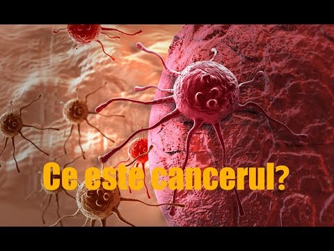 Gastric cancer ajcc