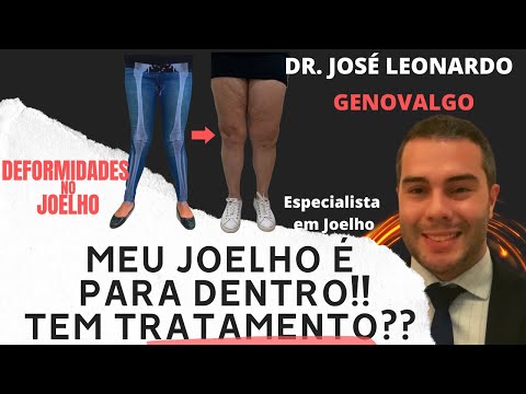 DOR NO JOELHO: Doutor, Meu Joelho É Para Dentro! Tem Tratamento? Joelho em Valgo