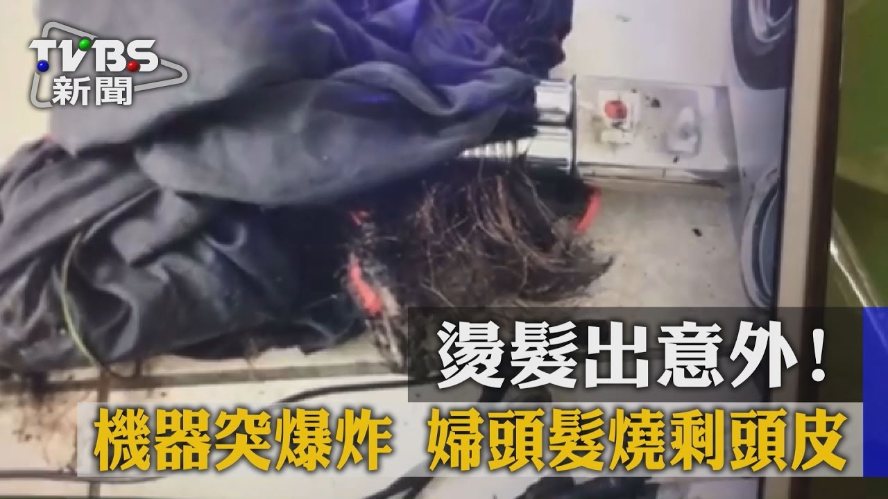 燙髮出意外！機器突爆炸　婦頭髮燒剩頭皮