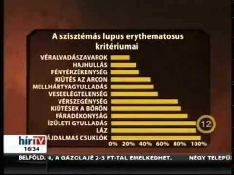 Szerbia ízületi kezelés
