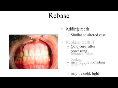 Reline Rebase the RPD