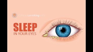 Eye Discharge, Eye Boogers, Rheum, Sleep in Your Eyes. What is it? What Causes It?