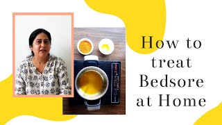 Bed sore treatment at Home | Home remedies for bed sores | How to treat Bedsores/Pressure sores