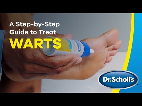 Dr. Scholl's | How To Use Freeze Away® Wart Remover