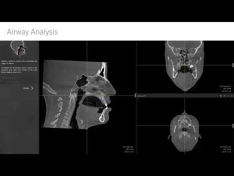Update Version 2.6 | IPS CaseDesigner® Info Series
