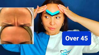 EFFECTIVE Way TO GET RID OF Wrinkles between eyebrows | How to get rid of FROWN LINES  naturally