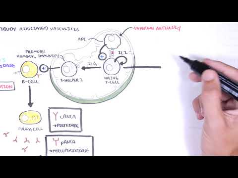 ANCA-assoziierte Vaskulitis (Antikörper gegen Zielantigene im Zytoplasma neutrophiler Granulozyten) – Ursachen, Pathophysiologie, Typen