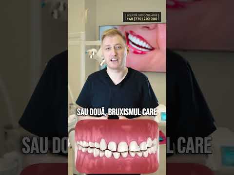 Ce poate duce la pierderea unui implant dentar?