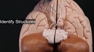 Quiz on Cranial Nerves