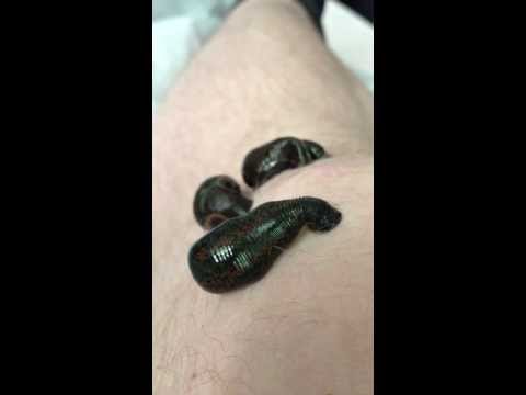 Prostamol uno Preise in den Apotheken von Moskau Prostata-Erkrankungen Fibrose