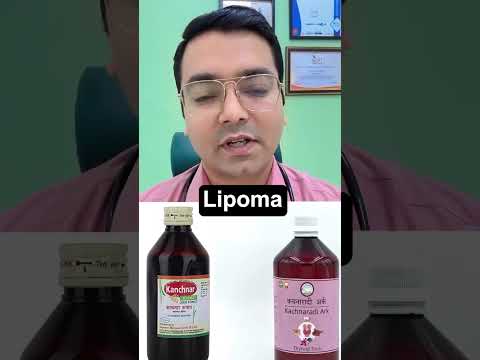 Treatment of Lipoma! #shorts