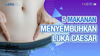 Download lagu Ingin Cepat Pulih Setelah Caesar? Ini 5 Makanan agar Luka Operasi Caesar Cepat Sembuh mp3