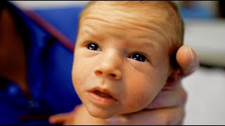 13 DAY OLD BABY WITH JAUNDICE! (What New Parents Need to Know) | Dr. Paul