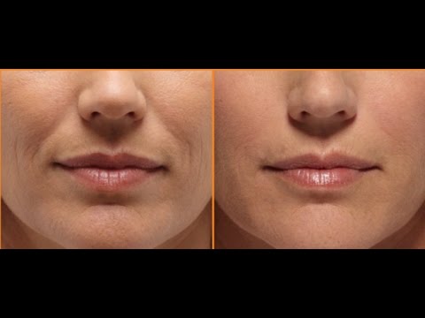 Smooth Out Smile Wrinkles With Face Massage / Laugh Wrinkles / Nasolabial Fold Video