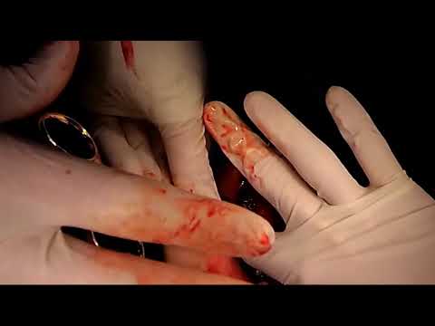 Articolazione della spalla nei bambini radiografia Dolore al collo e le sopracciglia