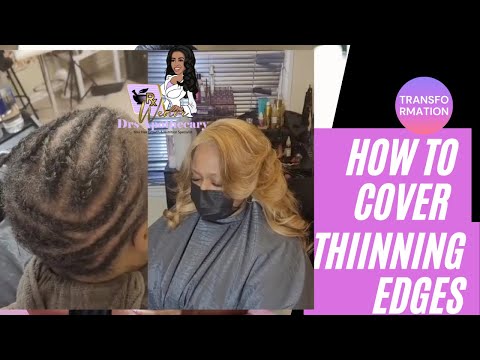 , title : 'How To Cover Thinning Edges'