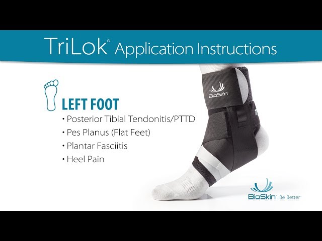 Video Teaser für TriLok - LEFT foot application for PTTD, Flat Feet, Plantar Fasciitis or Heel Pain