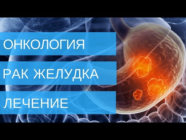 Как Лечить Асд Рак Желудка