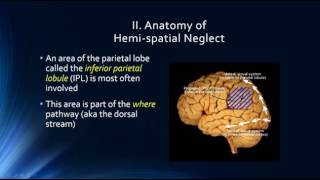 Neurophysiology of Attention: Hemi-spatial Neglect