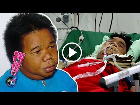 Hendrik Ceper Terbaring Koma - Cumicam 27 Juni 2016