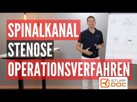 Spinal canal stenosis - These are the surgical procedures
