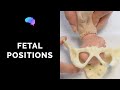 Types of Fetal Positions - OSCE Guide