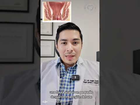 Luis Angel Cuadra Reyes-13