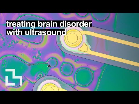 Implantable piezoelectric ultrasound stimulator (ImPULS) for ...