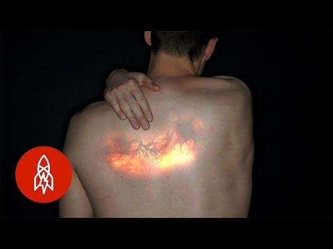 Feeling All the Feels: Living With Mirror-Touch Synesthesia