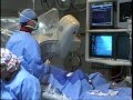 Surgery - Heart Catheterization 