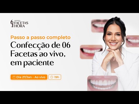 AULA 02 - CONFECÇÃO DE 06 FACETAS AO VIVO (EM PACIENTE)