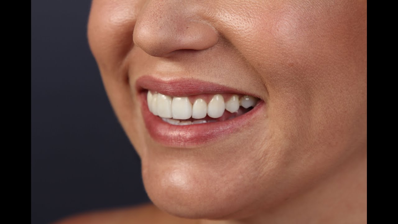 Patient Testimonial Video 1