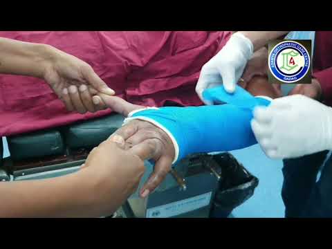 Fracture Lower end Radius | Ligamentotaxis method reduction | Fiberglass plastering | Adamya Hosp