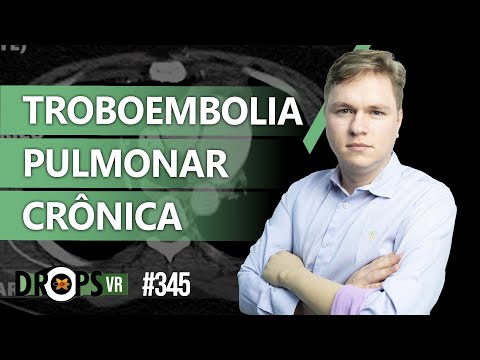 TROMBOEMBOLISMO PULMONAR CRÔNICO