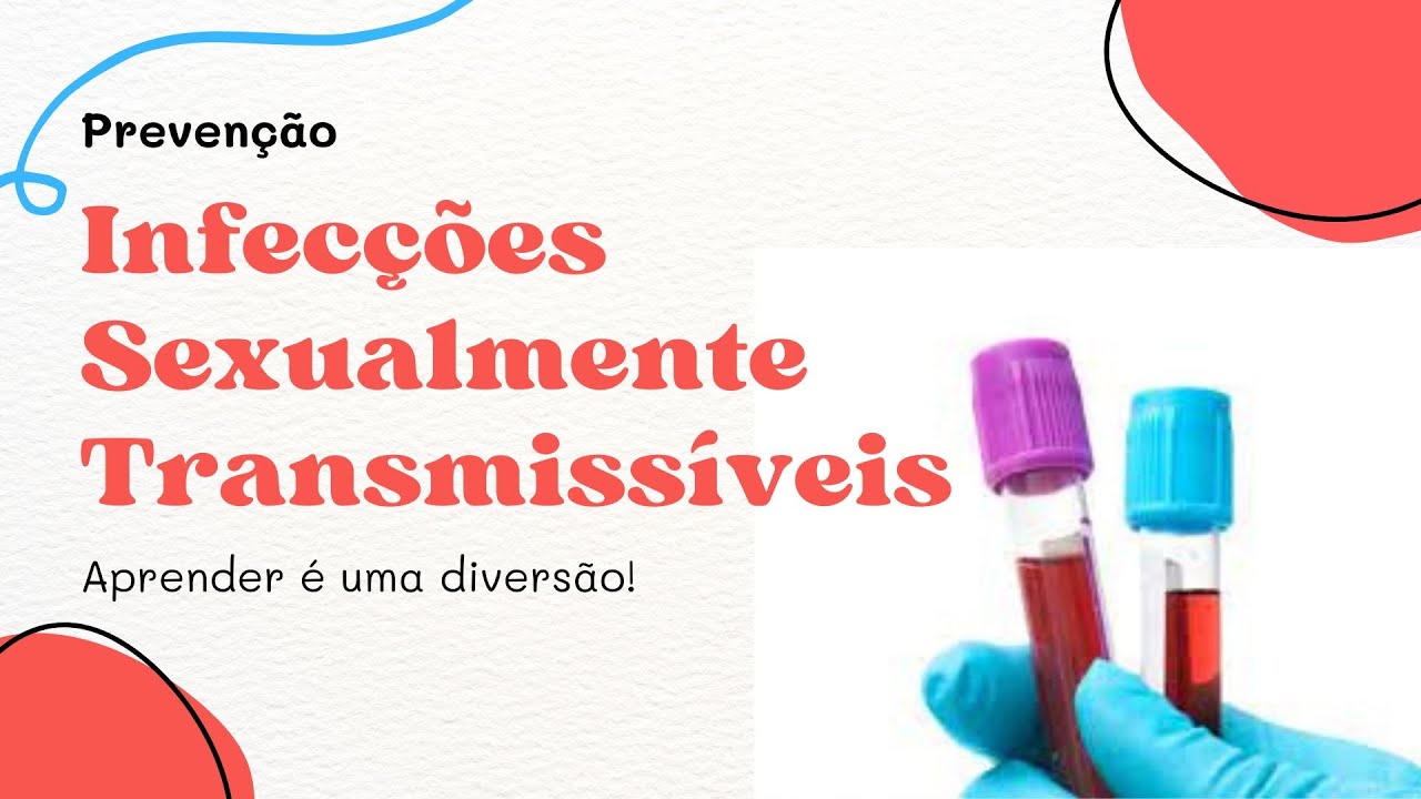 Aula Prática Sobre IST's - Dinâmica Para Jovens