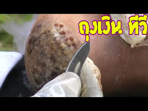 ที่หายกลากจุลินทรีย์ ในการรักษาเยียวยากลากพื้นบ้าน
