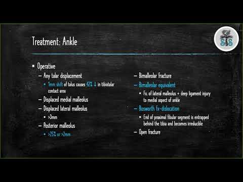 Ankle Fractures