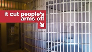 Rotary Jails and Accidental Amputations