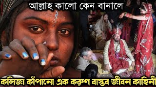 (সত্য ঘটনা) কালো চেহারার কারণে স্বামী হয়ে গেলেন বাবা ! Bangla real life story E-1478 APON