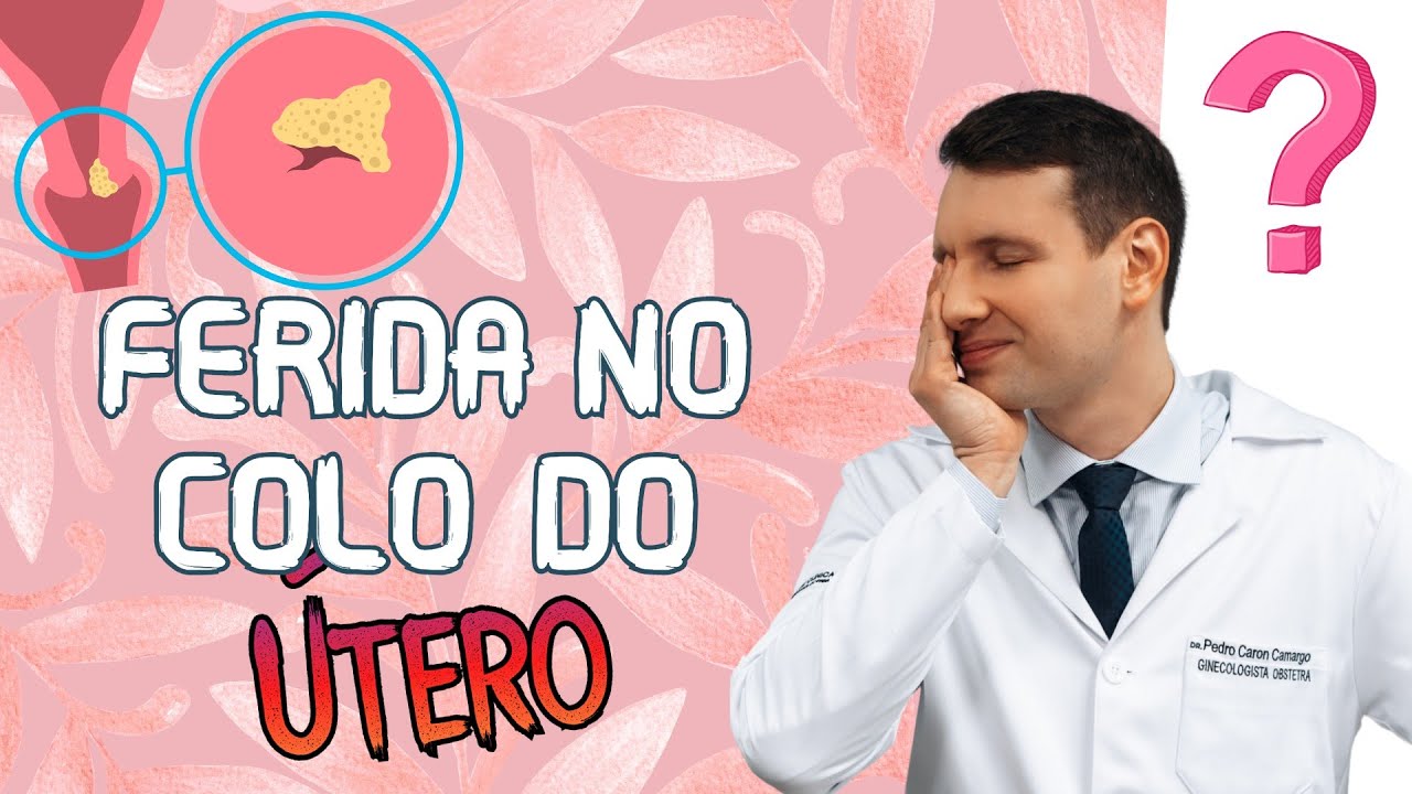 FERIDA NO COLO DO ÚTERO, o que é, sintomas, tratamento, prevenção