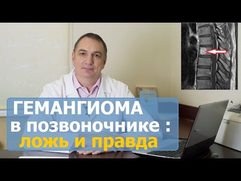 Боль в пояснице отдающая в ноги у мужчин Как правильно выбрать подушку для сна при остеохондрозе