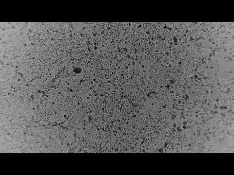 NYC Coronavirus Update