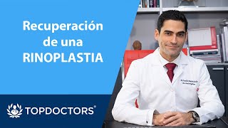 Cómo es la recuperación de una Rinoplastia - Dr. Franklin Mariño | Top Doctors (4/4)