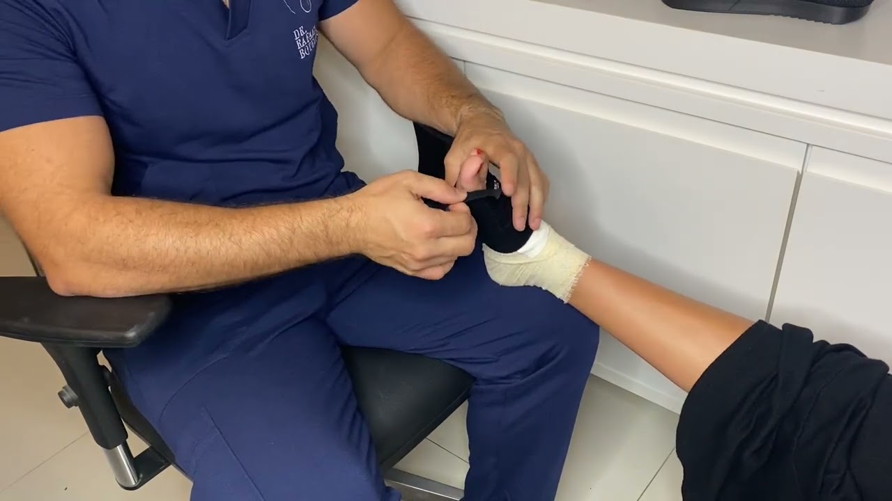 Como usar o posicionador de dedos após cirurgias minimamente invasivas nos pés