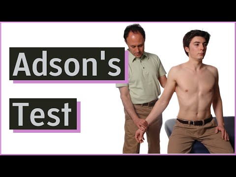Adson's Test | Thoracic Outlet Syndrome