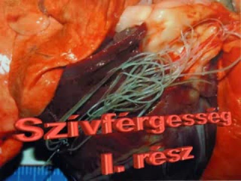 szivfergesseg gyogyithato parazitológusok orvosolják a férgeket