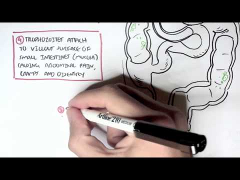 Giardiasis - Giardia Lamblia