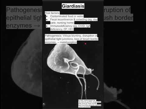 Giardiasis